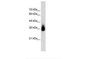 Image no. 1 for anti-Homeobox C9 (HOXC9) (N-Term) antibody (ABIN203532)