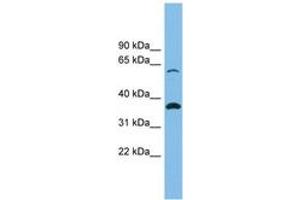 Image no. 1 for anti-Solute Carrier Family 25 (Mitochondrial Carrier, Adenine Nucleotide Translocator), Member 4 (SLC25A4) (AA 35-84) antibody (ABIN6744751) (SLC25A4 Antikörper  (AA 35-84))