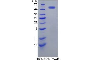 SDS-PAGE analysis of Human EGFR2 Protein. (EGFR2 Protein)