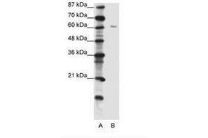 Image no. 1 for anti-Zinc Finger Protein 268A (ZNF286A) (C-Term) antibody (ABIN202711) (ZNF286A Antikörper  (C-Term))