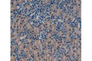 Used in DAB staining on fromalin fixed paraffin- embedded Kidney tissue (YAF2 Antikörper  (AA 1-179))