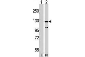 Western blot analysis of DAAM1 (arrow) using DAAM1 polyclonal antibody . (DAAM1 Antikörper  (N-Term))