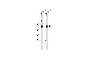 All lanes : Anti-HPX Antibody (Center) at 1:2000 dilution Lane 1: Human liver lysate Lane 2: Rat liver lysate Lysates/proteins at 20 μg per lane. (Hemopexin Antikörper  (AA 200-227))