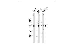 All lanes : Anti-INHBB Antibody (C-term at 1:4000 dilution Lane 1: A549 whole cell lysate Lane 2: PC-3 whole cell lysate Lane 3: Mouse testis lysate Lysates/proteins at 20 μg per lane. (INHBB Antikörper  (C-Term))