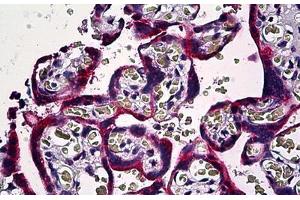 Human Placenta: Formalin-Fixed, Paraffin-Embedded (FFPE)