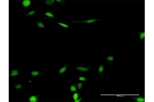 Immunofluorescence of purified MaxPab antibody to SMARCB1 on HeLa cell. (SMARCB1 Antikörper  (AA 1-385))