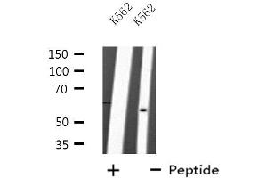 Western blot analysis of extracts from K562 cells, using TRAF2 antibody. (TRAF2 Antikörper  (C-Term))