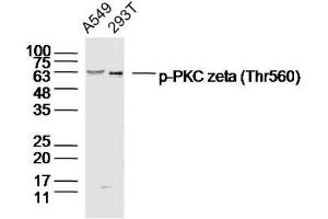 Lane 1: A549 Lane 2: 293T lysates probed with PKC zeta (Thr560) Polyclonal Antibody, Unconjugated  at 1:300 dilution and 4˚C overnight incubation. (PKC zeta Antikörper  (pThr560))