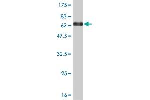 Western Blot detection against Immunogen (67. (MEIS2 Antikörper  (AA 1-381))