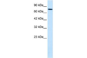 WB Suggested Anti-WHSC1 Antibody Titration:  0. (WHSC1 Antikörper  (N-Term))