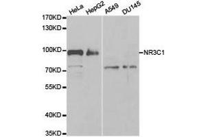 Western Blotting (WB) image for anti-Nuclear Receptor Subfamily 3, Group C, Member 1 (Glucocorticoid Receptor) (NR3C1) antibody (ABIN1873953) (Glucocorticoid Receptor Antikörper)