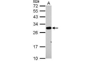 WB Image Prohibitin antibody detects PHB protein by Western blot analysis. (Prohibitin Antikörper)