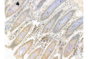 ABIN6261965 and ABIN6278698 at 1/100 staining human normal colon tissue by IHC-P. (GLI3 Antikörper  (Internal Region))