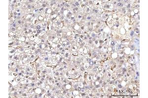 IHC analysis of RBP1 using anti-RBP1 antibody (ABIN7599586). (RBP1 Antikörper  (AA 10-135))