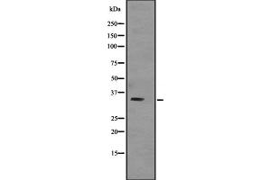 Western blot analysis of TNNT3 expression in Human skeletal muscle lysate; Mouse skeletal muscle lysate; Rat skeletal muscle lysate,The lane on the left is treated with the antigen-specific peptide. (TNNT3 Antikörper  (C-Term))