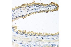 Immunohistochemistry of paraffin-embedded human prostate using COCH antibody (ABIN6132126, ABIN6138819, ABIN6138820 and ABIN6222234) at dilution of 1:100 (40x lens). (COCH Antikörper  (AA 20-260))