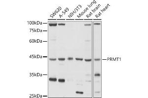 Western blot analysis of extracts of various cell lines, using PRMT1 antibody (ABIN3021311, ABIN3021312, ABIN3021313 and ABIN6214838) at 1:1000 dilution. (PRMT1 Antikörper  (AA 20-353))