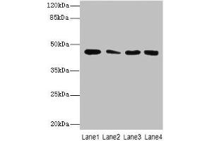 Western Blot All lanes: CBWD2 antibody at 6 μg/mL Lane 1: Mouse heart tissue Lane 2: Mouse liver tissue Lane 3: Mouse lung tissue Lane 4: Hela whole cell lysate Secondary Goat polyclonal to rabbit IgG at 1/10000 dilution Predicted band size: 45 kDa Observed band size: 45 kDa (CBWD2 Antikörper  (AA 96-395))