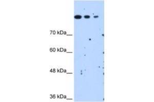 Western Blotting (WB) image for anti-SET Domain Containing 2 (SETD2) antibody (ABIN2463084) (SETD2 Antikörper)