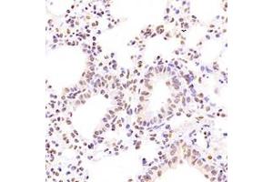 Immunohistochemistry analysis of paraffin-embedded mouse lung using,NCAPG2 (ABIN7074856) at dilution of 1: 1600 (NCAPG2 Antikörper)