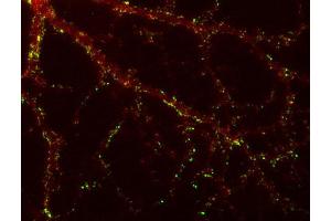 Indirect immunolabeling of PFA fixed rat hippocampus neurons with anti-SAP 102 (dilution 1 : 500; red) and mouse anti-synapsin 1 (cat. (DLG3 Antikörper)