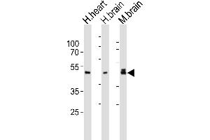 Western blot analysis of lysates from human heart, human brain, mouse brain tissue lysate (from left to right), using NDEL1 Antibody (Center) (ABIN6244172 and ABIN6577868). (NDEL1 Antikörper  (AA 178-213))