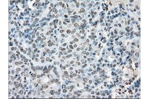 Image no. 2 for anti-P450 (Cytochrome) Oxidoreductase (POR) antibody (ABIN1497746) (POR Antikörper)