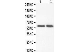 Anti-FMO3 antibody, Western blotting Lane 1: Rat Liver Tissue Lysate Lane 2: Rat Liver Tissue Lysate
