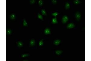 Immunofluorescence staining of A549 cells with ABIN7155365 at 1:133, counter-stained with DAPI. (HIST1H2AC Antikörper  (AA 2-130))