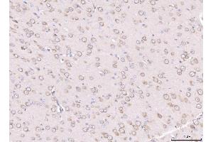 IHC analysis of RPL29 using anti-RPL29 antibody (ABIN7600993). (RPL29 Antikörper  (AA 27-153))