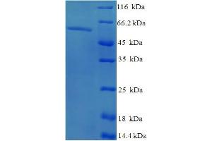SDS-PAGE (SDS) image for Exonuclease 5 (EXO5) (AA 1-373), (full length) protein (His-SUMO Tag) (ABIN5711779)