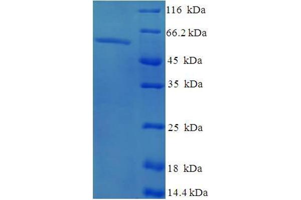 EXO5 Protein (AA 1-373, full length) (His-SUMO Tag)