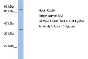 Host: Rabbit Target Name: ZFX Sample Type: ACHN Whole cell lysates Antibody Dilution: 1.