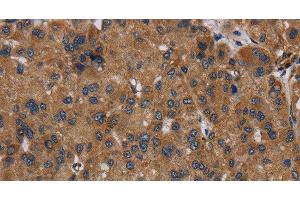 Immunohistochemistry (Paraffin-embedded Sections) (IHC (p)) image for anti-NADH Dehydrogenase (Ubiquinone) Fe-S Protein 8, 23kDa (NADH-Coenzyme Q Reductase) (NDUFS8) antibody (ABIN7241747)