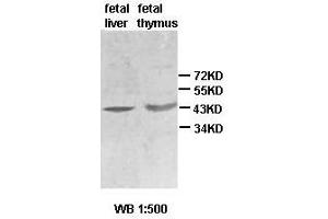 Western blot analysis of fetal liver and thymus lysate, using ACTBL2 antibody. (ACTBL2 Antikörper  (Middle Region))