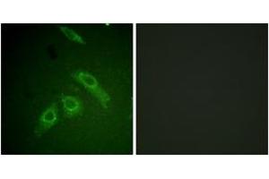 Immunofluorescence analysis of HepG2 cells, using FAK (Phospho-Ser910) Antibody. (FAK Antikörper  (pSer910))