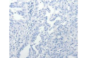 Immunohistochemistry (IHC) image for anti-USO1 Homolog, Vesicle Docking Protein (USO1) antibody (ABIN1875291) (USO1 Antikörper)