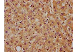 IHC image of ABIN7149649 diluted at 1:700 and staining in paraffin-embedded human liver tissue performed on a Leica BondTM system. (DLL3 Antikörper  (AA 27-492))