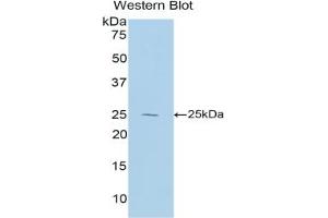 Western blot analysis of the recombinant protein. (IL-27 Antikörper  (AA 32-234))