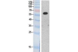 Western Blotting (WB) image for anti-Histone Deacetylase 1 (HDAC1) (Internal Region) antibody (ABIN3187983)