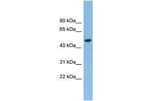WB Suggested Anti-PTPRR Antibody Titration: 0. (PTPRR Antikörper  (N-Term))