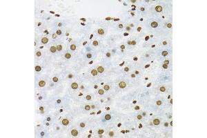 Immunohistochemistry of paraffin-embedded mouse liver using KHDRBS1 antibody (ABIN5975824) at dilution of 1/100 (40x lens). (KHDRBS1 Antikörper)