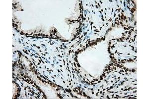 Image no. 3 for anti-Aryl Hydrocarbon Receptor Nuclear Translocator (ARNT) antibody (ABIN1496729) (ARNT Antikörper)