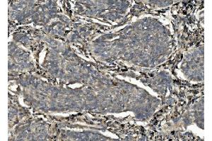 IHC analysis of Caspase-7/CASP7 using anti-Caspase-7/CASP7 antibody (ABIN7600823). (Caspase 7 Antikörper  (AA 24-303))