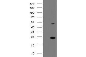 Western Blotting (WB) image for anti-Eukaryotic Translation Initiation Factor 5A2 (EIF5A2) antibody (ABIN1497996) (EIF5A2 Antikörper)
