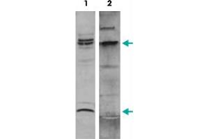 Western Blot (Cell lysate) analysis of nuclear extracts of ME-1 cells. (MYH11 Antikörper  (C-Term))