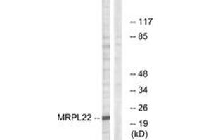 Western Blotting (WB) image for anti-Mitochondrial Ribosomal Protein L22 (MRPL22) (AA 91-140) antibody (ABIN2890053) (MRPL22 Antikörper  (AA 91-140))