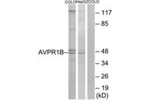 Western Blotting (WB) image for anti-Arginine Vasopressin Receptor 1B (AVPR1B) (AA 275-324) antibody (ABIN2891100) (AVPR1B Antikörper  (AA 275-324))