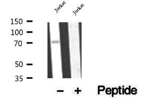 Western blot analysis of extracts of Jurkat cells, using CCDC93 antibody. (CCDC93 Antikörper  (C-Term))