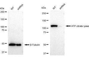 Western blotting analysis using ATP citrate lyase antibody (ABIN7797679). (Rekombinanter ACLY Antikörper)